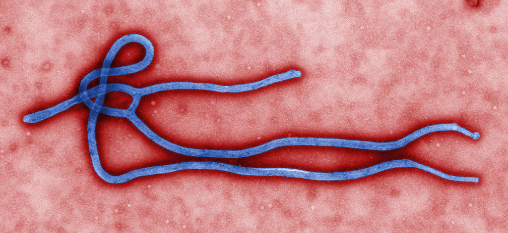 Ebola Lawsuit Texas