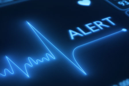 Flat Line Alert on IVC Filter Injury