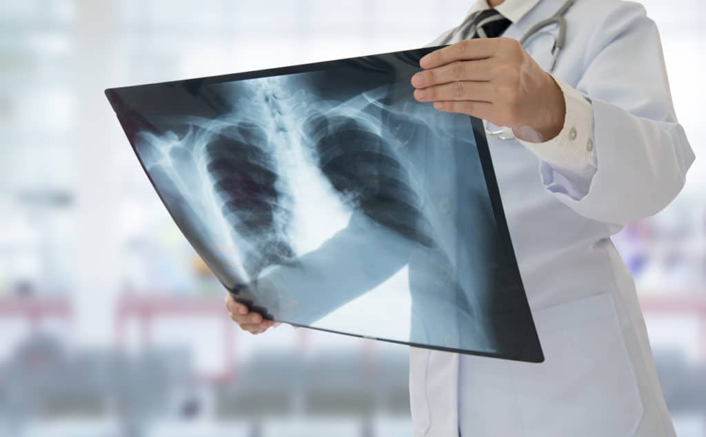 FDA Urges "Child Size" X-Ray Radiation Doses
