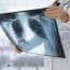 FDA Urges "Child Size" X-Ray Radiation Doses