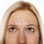 Neutrogena Light Mask Recalled for Risk of Vision Loss