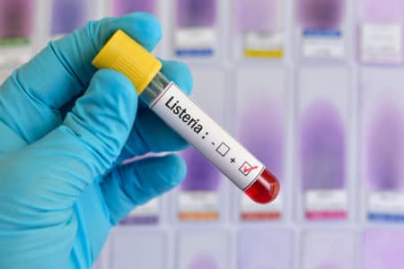 Listeria Food Poisoning