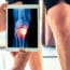 Exactech Recalls 140,000 Knee & Ankle Replacements for Failure Risk