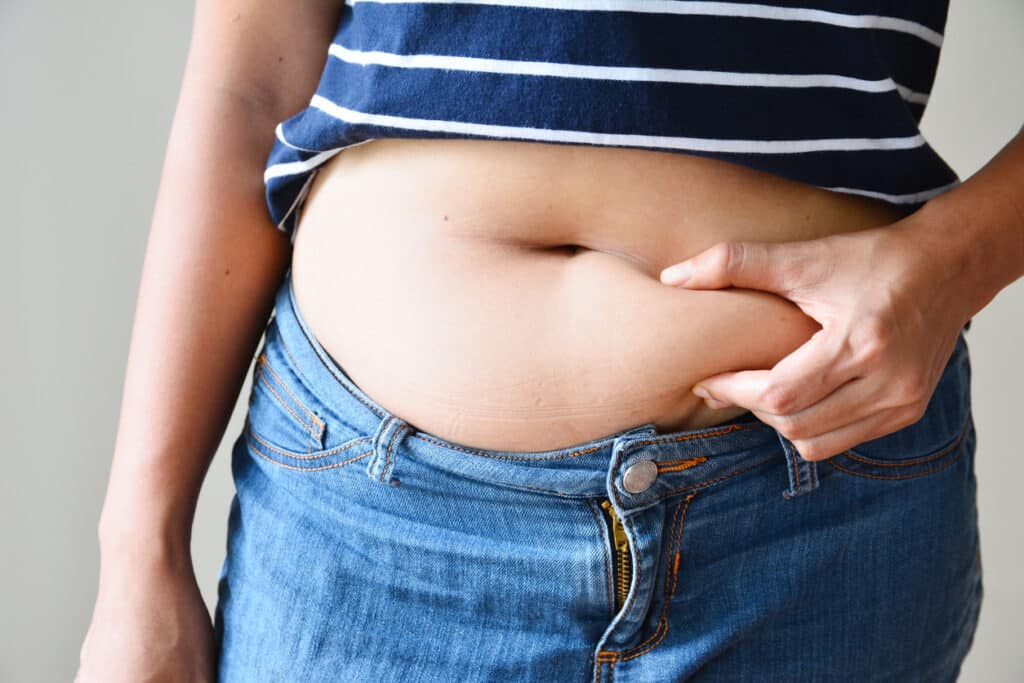 CoolSculpting Surgery Linked to Ugly Side Effects