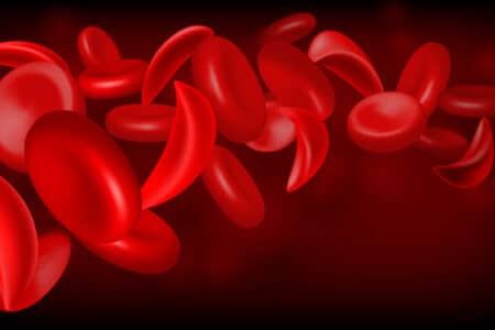 Sickle Cell Drug Oxbryta Pulled Off Market for Safety Risks