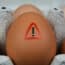 Sunshine Yolk Egg Salmonella Outbreak Sickens 95 People