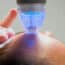 FDA Warning Links RF Microneedling to Burn Injuries and Scarring