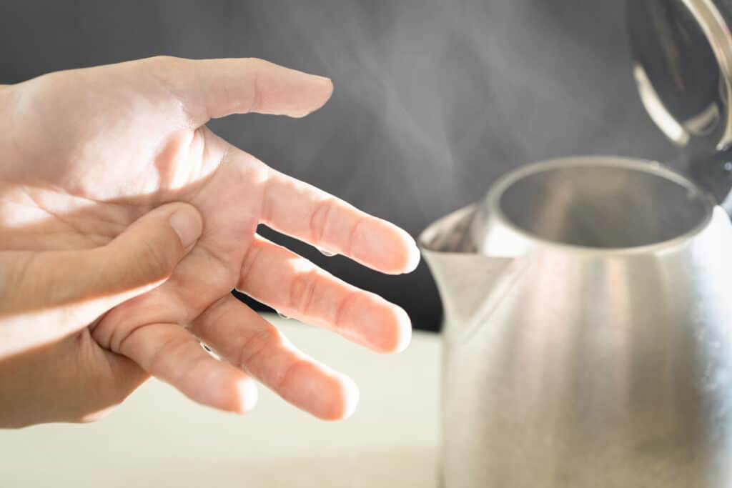 Warning for Sekaer Electric Kettles After 89 Burn Injuries Reported